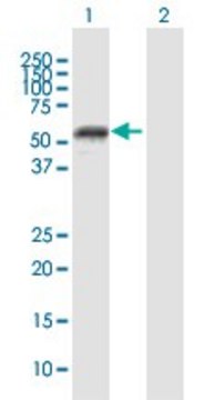 Anti-MMP1 antibody produced in mouse purified immunoglobulin, buffered aqueous solution