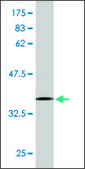 Monoclonal Anti-ASCC2, (C-terminal) antibody produced in mouse clone 2F7, ascites fluid