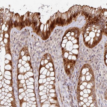 Anti-CA7 antibody produced in rabbit Prestige Antibodies&#174; Powered by Atlas Antibodies, affinity isolated antibody, buffered aqueous glycerol solution