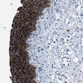 Anti-CD1B antibody produced in rabbit Prestige Antibodies® Powered by Atlas Antibodies, affinity isolated antibody, buffered aqueous glycerol solution