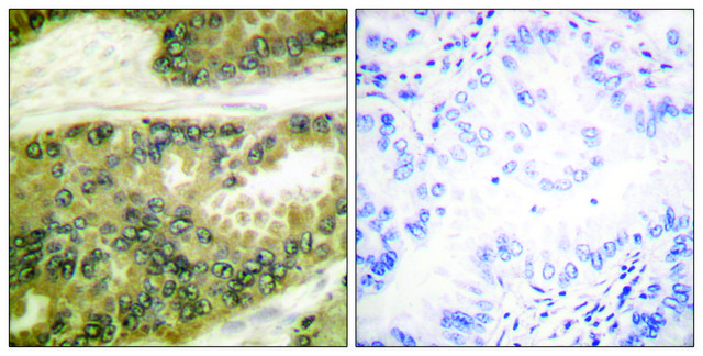 Anti-Cyclin D3 antibody produced in rabbit affinity isolated antibody