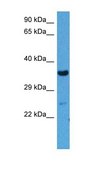 Anti-WNT3 antibody produced in rabbit affinity isolated antibody