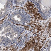 Anti-BTN2A1 antibody produced in rabbit Prestige Antibodies® Powered by Atlas Antibodies, affinity isolated antibody, buffered aqueous glycerol solution