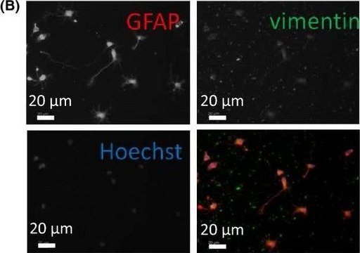 Anti-Vimentin antibody produced in rabbit affinity isolated antibody