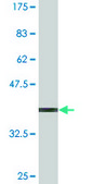 Monoclonal Anti-RNF40 antibody produced in mouse clone 1C1, purified immunoglobulin, buffered aqueous solution