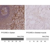 Anti-PYCARD antibody produced in rabbit Prestige Antibodies® Powered by Atlas Antibodies, affinity isolated antibody, buffered aqueous glycerol solution