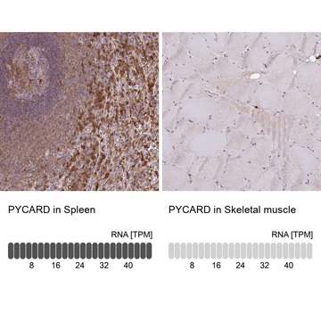 Anti-PYCARD antibody produced in rabbit Prestige Antibodies&#174; Powered by Atlas Antibodies, affinity isolated antibody, buffered aqueous glycerol solution