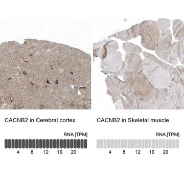 Anti-CACNB2 antibody produced in rabbit Prestige Antibodies&#174; Powered by Atlas Antibodies, affinity isolated antibody, buffered aqueous glycerol solution