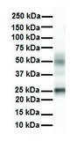 Anti-TMED1 antibody produced in rabbit affinity isolated antibody