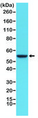 Anti-Cytokeratin 8 antibody, Rabbit monoclonal recombinant, expressed in HEK 293 cells, clone RM266, purified immunoglobulin