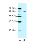 Anti-CPSF6 antibody produced in rabbit IgG fraction of antiserum