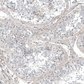 Anti-HRNR antibody produced in rabbit Prestige Antibodies® Powered by Atlas Antibodies, affinity isolated antibody, buffered aqueous glycerol solution