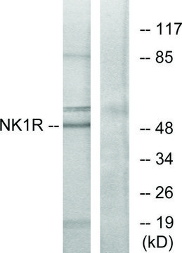 Anti-NK1R antibody produced in rabbit affinity isolated antibody