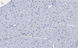 Anti-Dystrophin Antibody, clone 2C6 (MANDYS106) ZooMAb® Mouse Monoclonal recombinant, expressed in HEK 293 cells