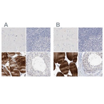 Anti-MYOT antibody produced in rabbit Prestige Antibodies&#174; Powered by Atlas Antibodies, affinity isolated antibody, buffered aqueous glycerol solution