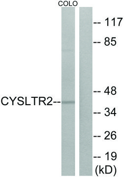 Anti-CYSLTR2 antibody produced in rabbit affinity isolated antibody