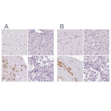 Anti-POMC antibody produced in rabbit Prestige Antibodies&#174; Powered by Atlas Antibodies, affinity isolated antibody