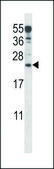 ANTI-ANKRD22 (C-TERM) antibody produced in rabbit IgG fraction of antiserum, buffered aqueous solution