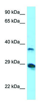 Anti-VSIG4 (N-terminal) antibody produced in rabbit affinity isolated antibody