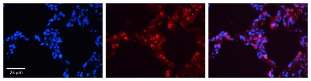 Anti-SFTPB antibody produced in rabbit affinity isolated antibody