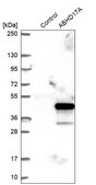 Anti-ABHD17A antibody produced in rabbit Prestige Antibodies® Powered by Atlas Antibodies, affinity isolated antibody, buffered aqueous glycerol solution