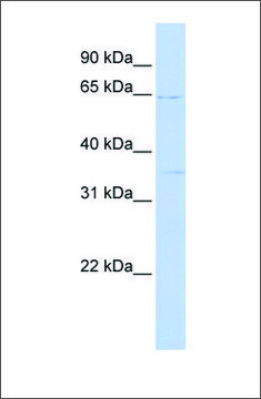 Anti-RORA (ab2) antibody produced in rabbit affinity isolated antibody