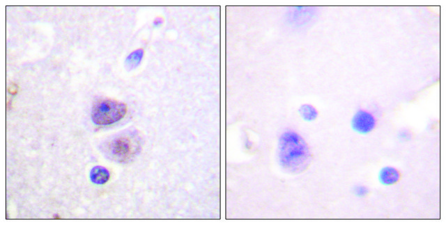 Anti-p38 MAPK antibody produced in rabbit affinity isolated antibody