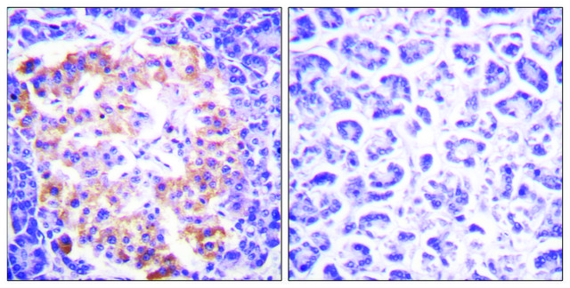 Anti-Collagen III antibody produced in rabbit affinity isolated antibody