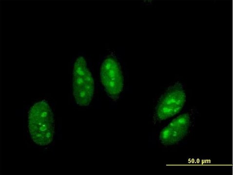 Anti-ADARB1 antibody produced in mouse purified immunoglobulin, buffered aqueous solution