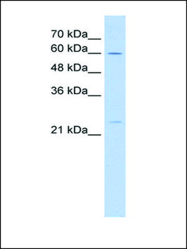 Anti-GINS1 IgG fraction of antiserum