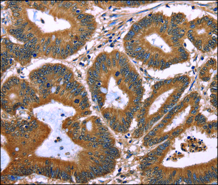 Anti-TDP2 antibody produced in rabbit affinity isolated antibody