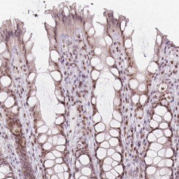 Anti-KAT6A antibody produced in rabbit Prestige Antibodies&#174; Powered by Atlas Antibodies, affinity isolated antibody