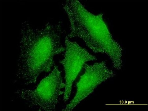 Monoclonal Anti-LMO3, (C-terminal) antibody produced in mouse clone 1A8, purified immunoglobulin, buffered aqueous solution