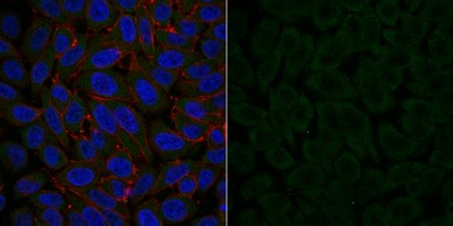 Anti-Dynein Antibody, IC, cytosolic, clone 74.1, Alexa Fluor&#8482; 488 Conjugate clone 74.1, from mouse, ALEXA FLUOR&#8482; 488