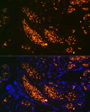 Anti-HBG1 Antibody, clone 6F1A8, Rabbit Monoclonal