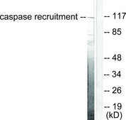 Anti-CARD6 antibody produced in rabbit affinity isolated antibody