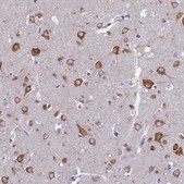 Anti-NLRP12 antibody produced in rabbit Prestige Antibodies® Powered by Atlas Antibodies, affinity isolated antibody, buffered aqueous glycerol solution