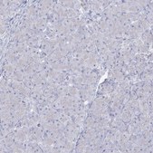 Anti-SLC6A19 antibody produced in rabbit Prestige Antibodies® Powered by Atlas Antibodies, affinity isolated antibody, buffered aqueous glycerol solution