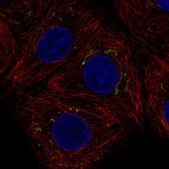 Anti-AIG1 antibody produced in rabbit Prestige Antibodies® Powered by Atlas Antibodies, affinity isolated antibody, buffered aqueous glycerol solution