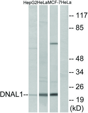 Anti-DNAL1 antibody produced in rabbit affinity isolated antibody