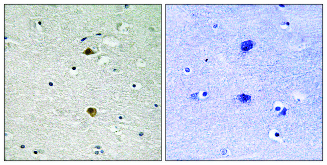 Anti-NF-&#954;B p65 antibody produced in rabbit affinity isolated antibody