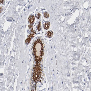 Anti-TSPAN6 antibody produced in rabbit Prestige Antibodies&#174; Powered by Atlas Antibodies, affinity isolated antibody, buffered aqueous glycerol solution