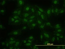 Monoclonal Anti-KLF11 antibody produced in mouse clone 8F4, purified immunoglobulin, buffered aqueous solution