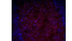 Anti-LMO2 (Rhombotin-2) Antibody, clone 299B clone 299B, from mouse