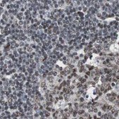 Anti-ZHX2 antibody produced in rabbit Prestige Antibodies® Powered by Atlas Antibodies, affinity isolated antibody, buffered aqueous glycerol solution