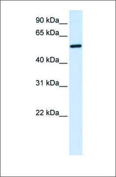 Anti-ALAS2 (ab2) antibody produced in rabbit affinity isolated antibody