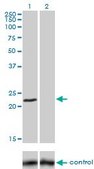 Monoclonal Anti-FXN antibody produced in mouse clone 3G9, purified immunoglobulin, buffered aqueous solution