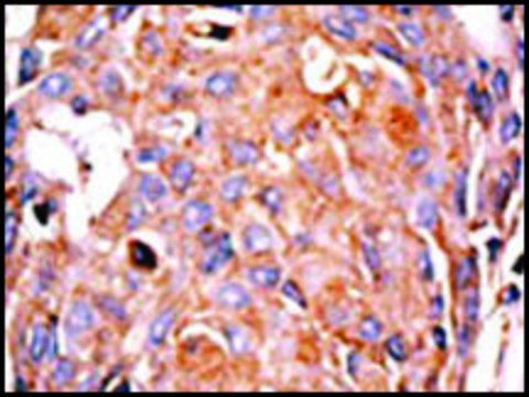 Anti-ADCK2 (C-term) antibody produced in rabbit IgG fraction of antiserum, buffered aqueous solution