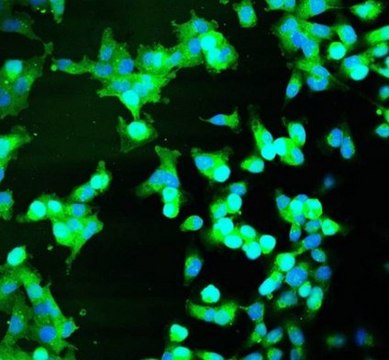 BioTracker胱氨酸-FITC活细胞染料 Live cell imaging dye that measures cystine uptake at the single cell level used to detect glutathione (GSH) synthesis, reactive oxygen species (ROS) detoxification, T-cell activation and B-cell development.