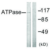 Anti-ATPASE antibody produced in rabbit affinity isolated antibody